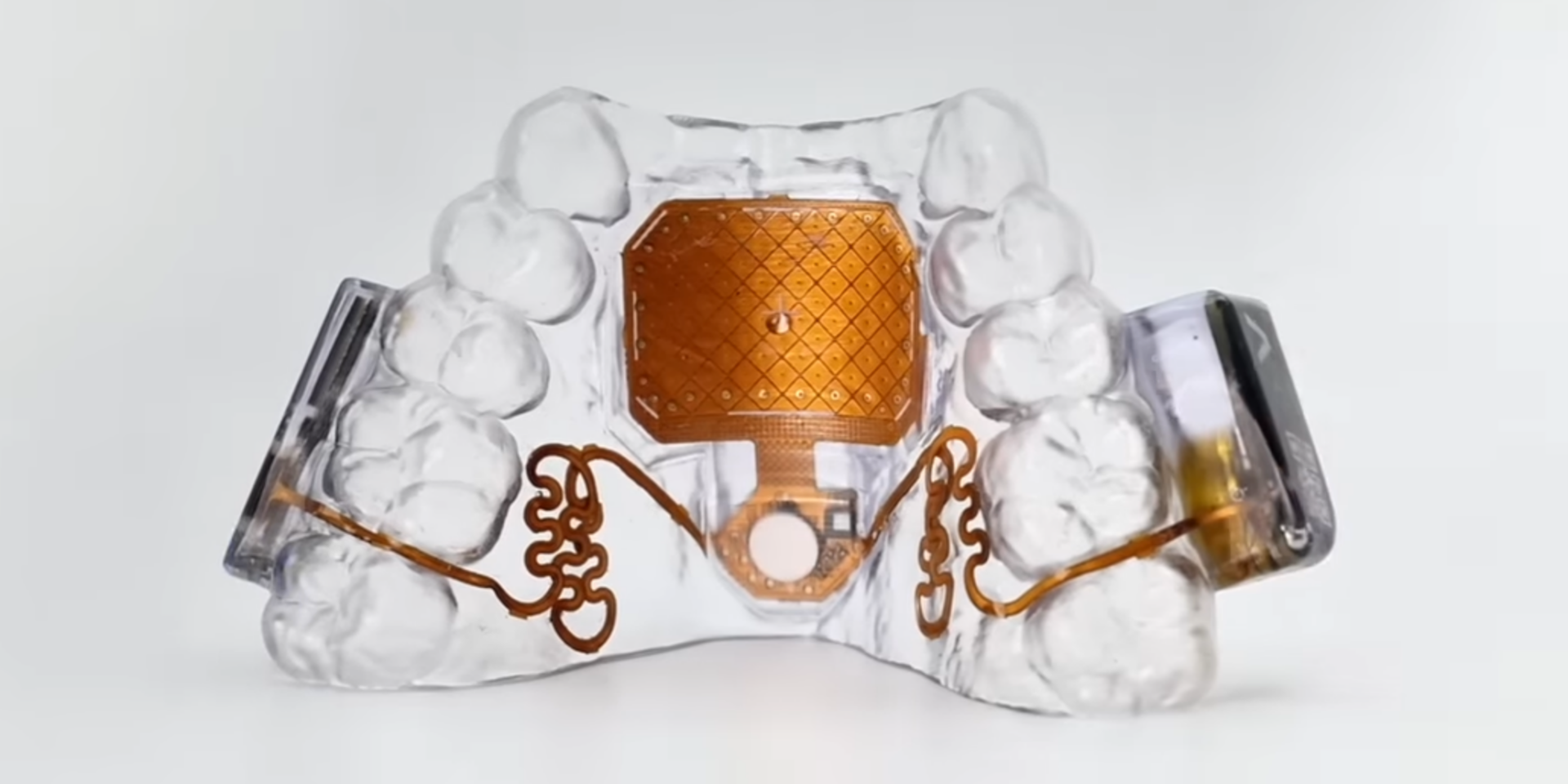 MouthPad – this is amazing.